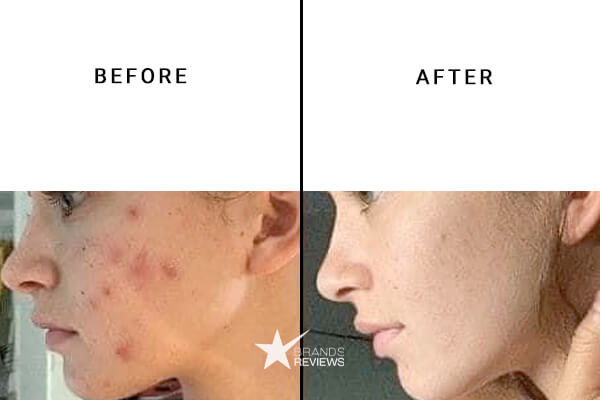 NourishMax Vitamin C Serum Before and After