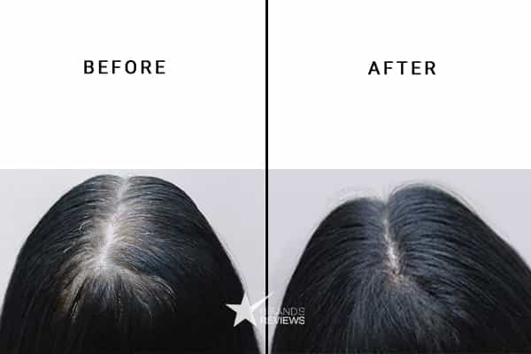 NourishVita Hair Supplement Vitamin Before and After