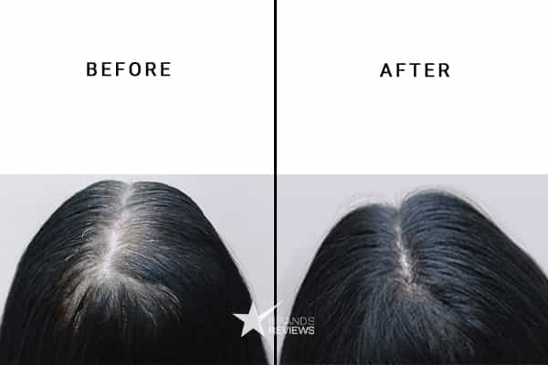 NourishVita Hair Supplement Vitamin Before and After