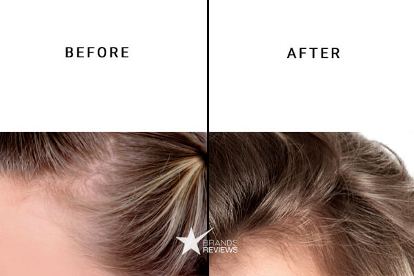 Nutrafol Hair Supplement Vitamin Before and After