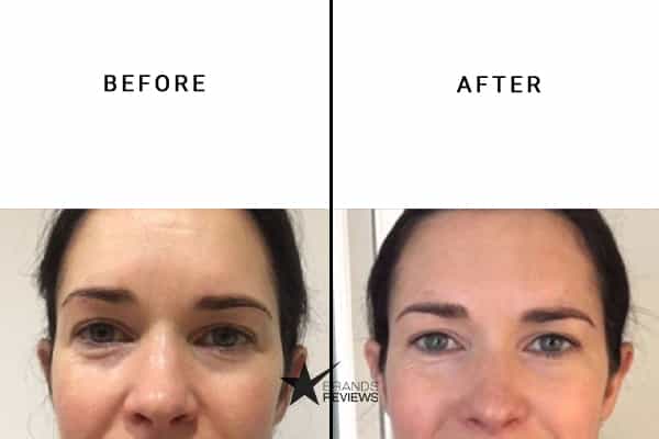Olay Collagen Serum Before and After