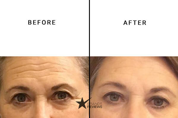 Olay Peptide Serum Before and After