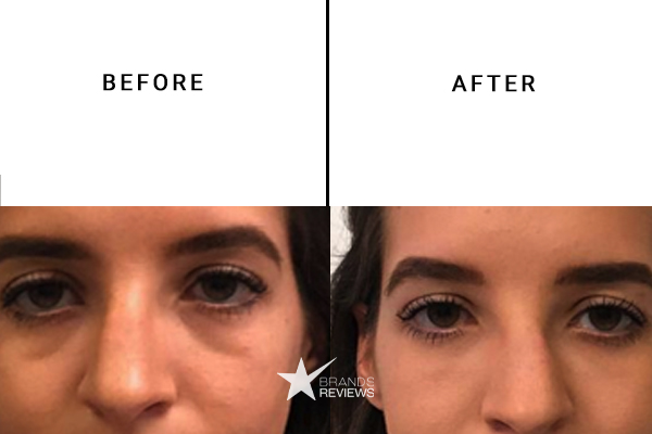 Ole Henriksen Eye Cream Before and After