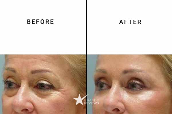 Paula's Choice Anti-Aging Serum Before and After