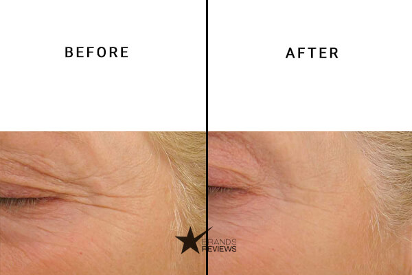 Paula's Choice peptide serum Before and After