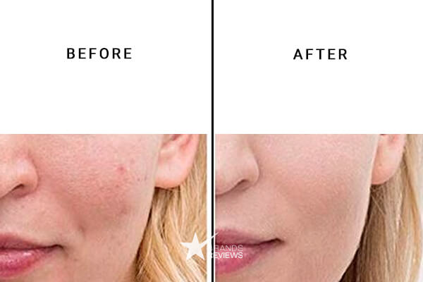 Paula's Choice Retinol Cream Before and After