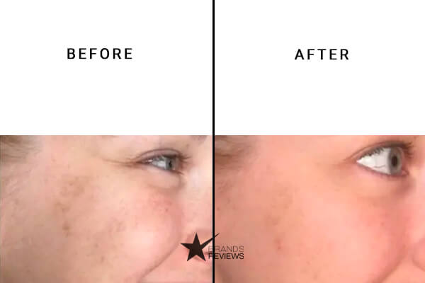 Paula's Choice Vitamin C Serum Before and After