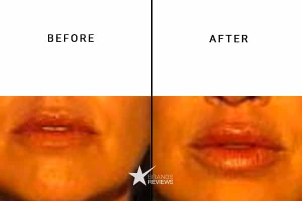 PCA Skin Lip Plumper Before and After
