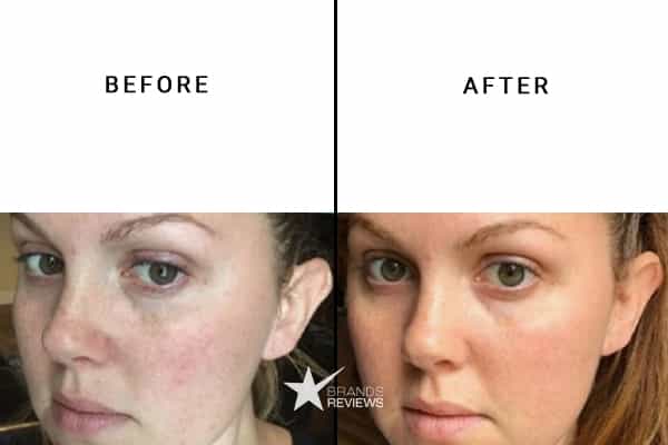 Peter Thomas Roth Collagen Serum Before and After