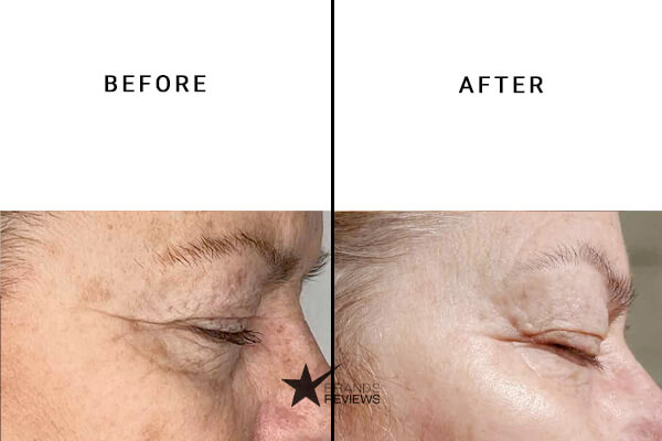 Peter Thomas Roth peptide Serum Before and After