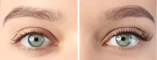 WooLash Eyelash Serum Before and After
