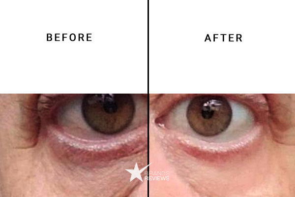 PotentLift Eye Cream Before and After