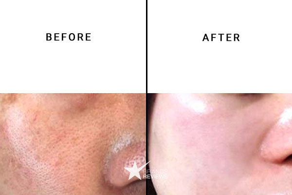 PotentLift Face Cleanser Before and After