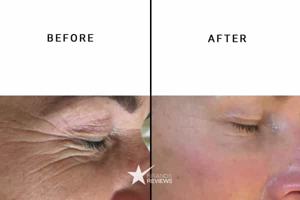 PotentLift Hyaluronic Acid Serum Before and After