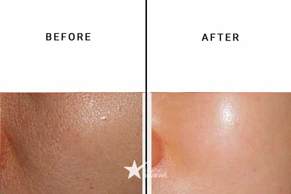 PotentLift Night Serum Before and After