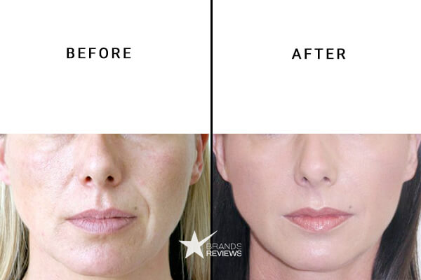 PotentLift Peptide Serum Before and After