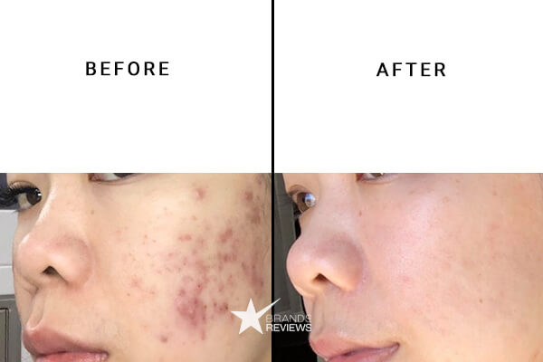 PotentLift Vitamin C Serum Before and After