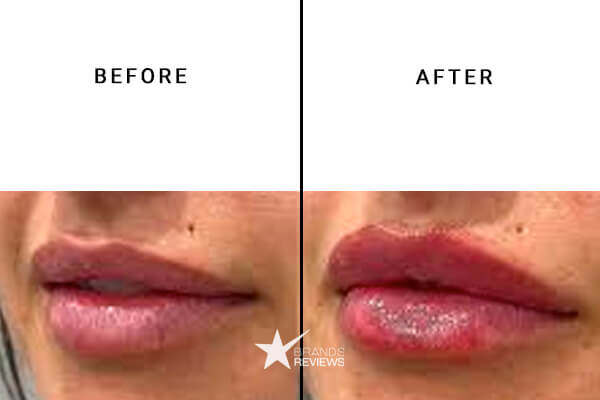 PureKana CBD lip balm before and after