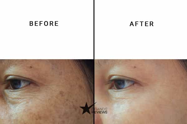 Ren Firming Mask Before and After