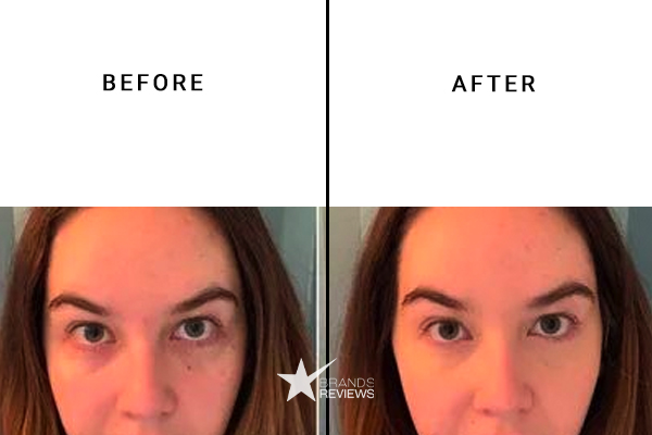 Rodan And Fields Eye Cream Before and After