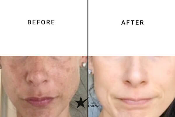 Seratopical cbd Face Cream Before and After
