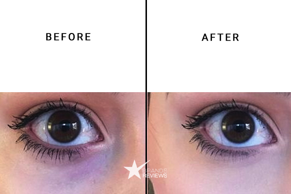 SK-II Eye Cream Before and After
