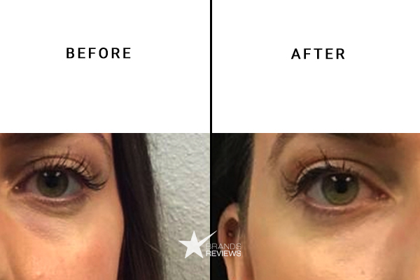 SkinMedica Eye Cream Before and After
