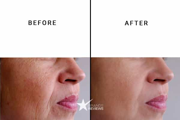 Skinceuticals Anti-Aging Serum Before and After