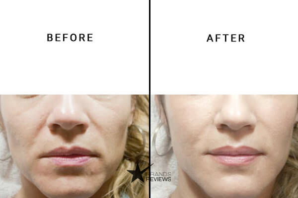 SkinCeuticals Antioxidant Serum Before and After