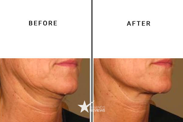 SkinCeuticals Neck Firming Cream Before an After