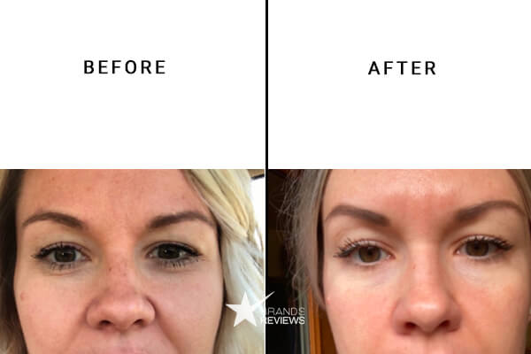 Skinceuticals Vitamin C Serum Before and After