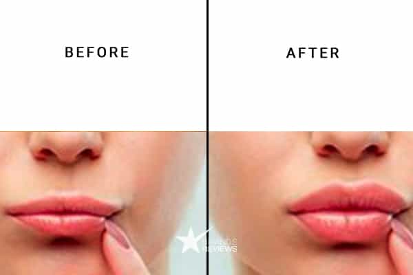 SkinMedica Lip Plumper Before and After