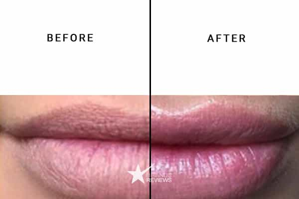 Skyn Iceland Lip Plumper Before and After