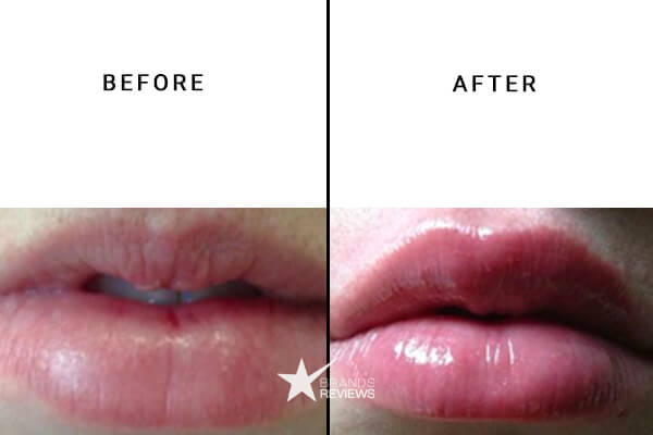 Social CBD Lip Balm Before and After