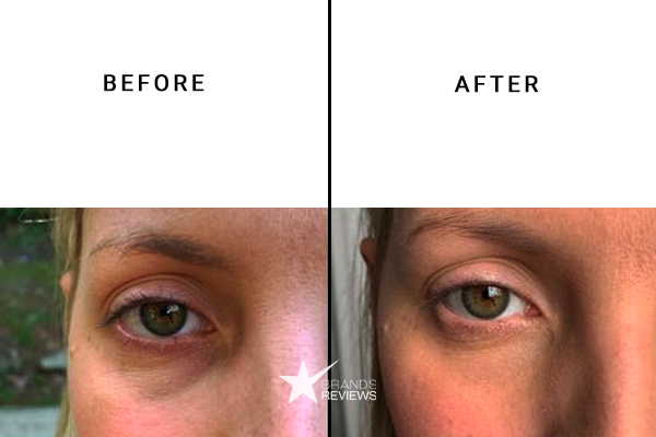 Soroci Eye Cream Before and After