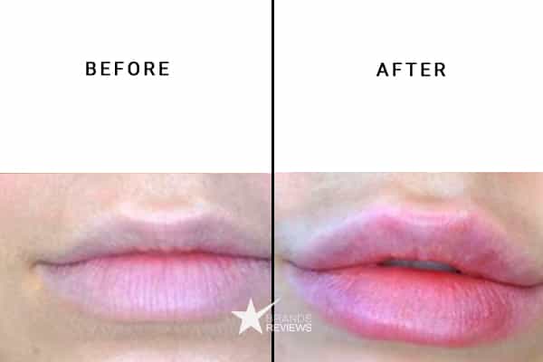 Strivectin Lip Plumper Before and After