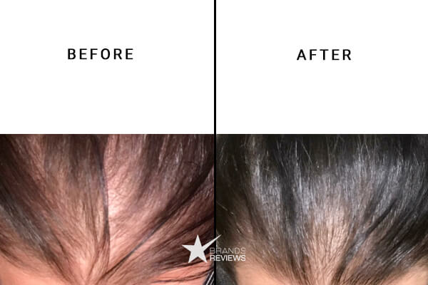 SugarBear Hair Supplement Vitamin Before and After