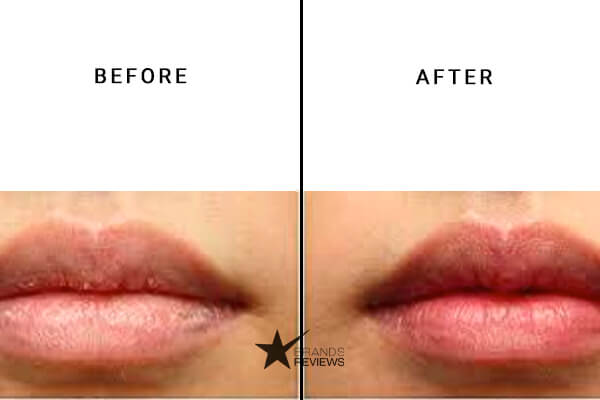 Susan’s CBD Hemp Lip Balm Before and After