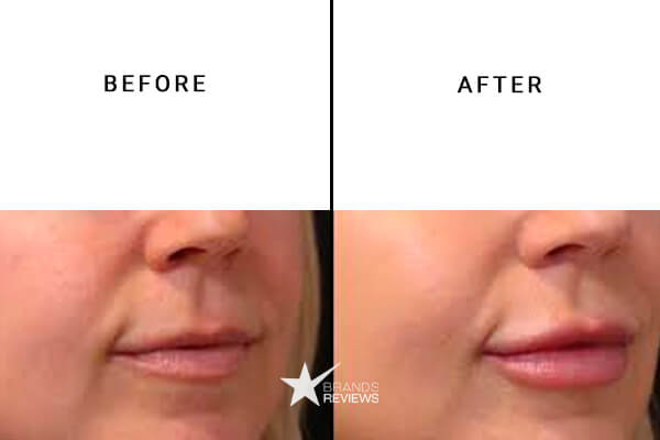 Veritas Farms CBD Lip Balm Before and After