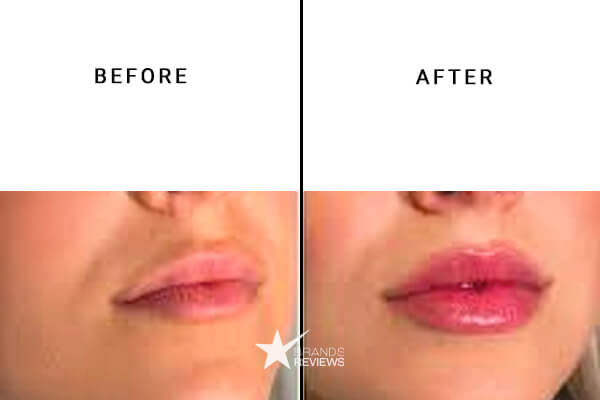 Vertly CBD Lip Balm Before and After