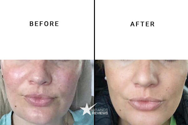 Volition Beauty Vitamin C Serum Before and After