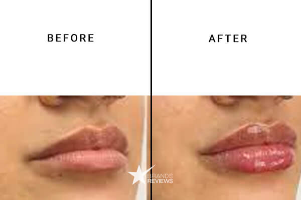 WLDKAT CBD Lip Balm Before and After