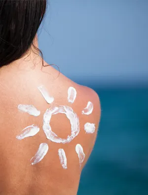 Best Sunburn Creams